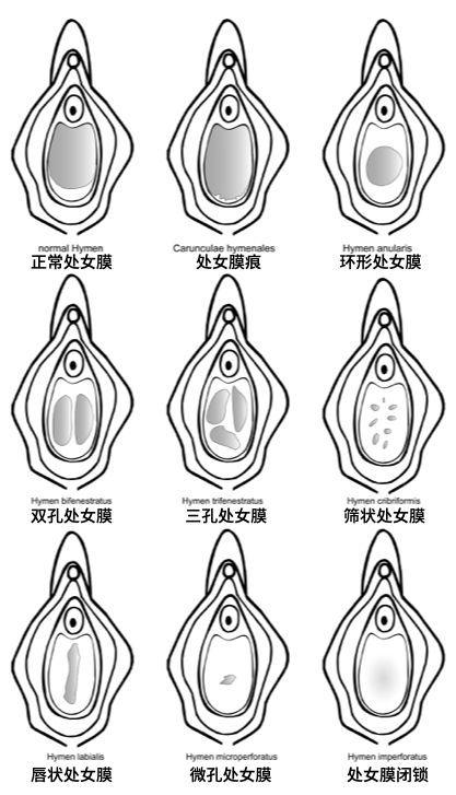  内容深刻解析处破女处破全过第一次